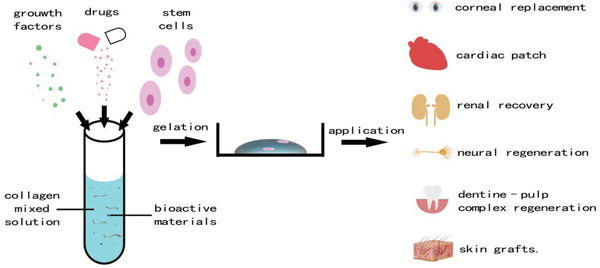 Type 2 collagen use1