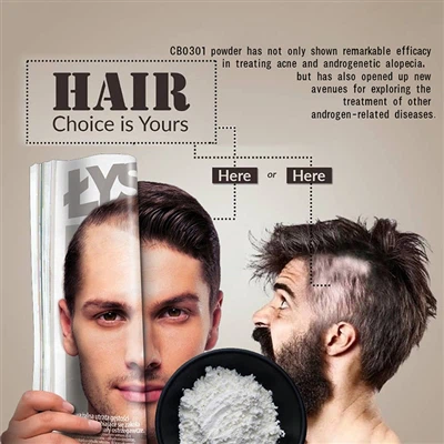 なぜ頭皮にニキビができてしまうのでしょうか？専門家が頭皮ニキビとフケを解説