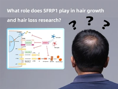 SFRP1は発毛と脱毛の研究においてどのような役割を果たしますか