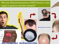 なぜ DHT が前立腺と毛髪の研究の主要なターゲットになったのか