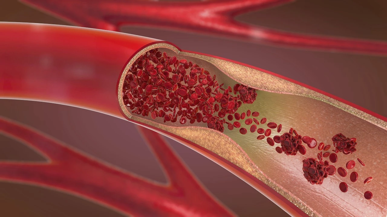 Blood vessel Blood vessel